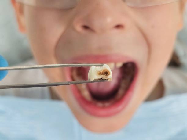 Best Emergency Dentist for Knocked-Out Tooth in Leisuretowne, NJ